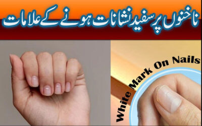 Nakhano Per Safaid Nishanaat Ka Kya Matlab Hai