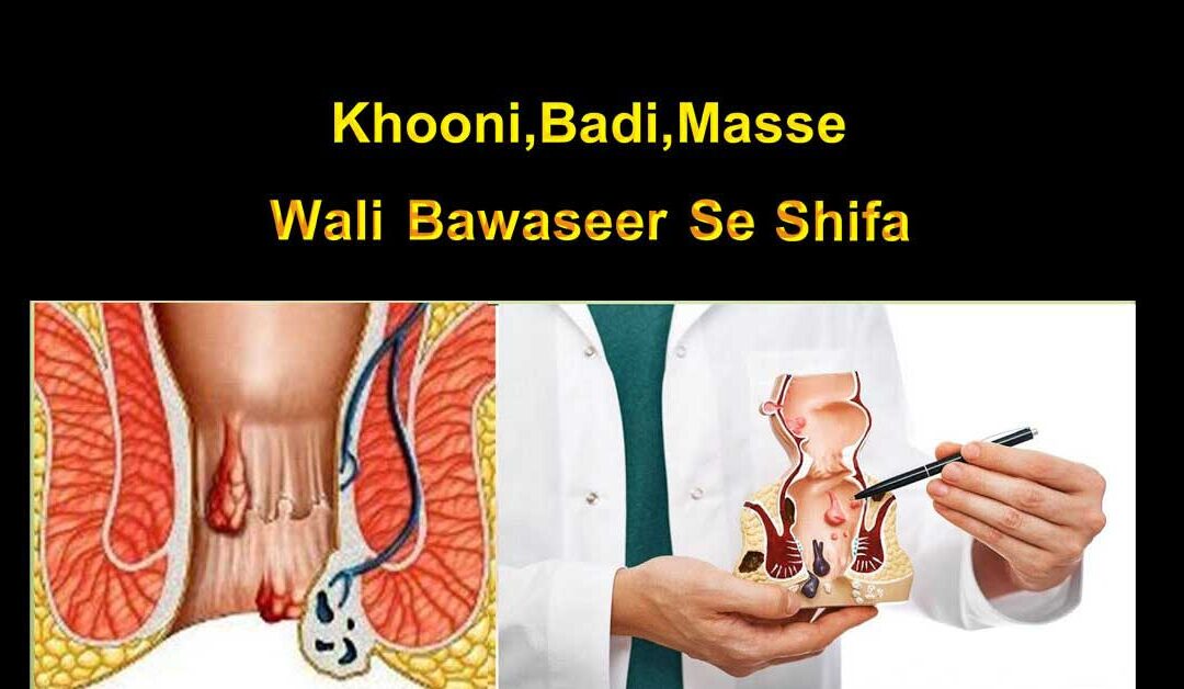 khuni bawaseer se shifa