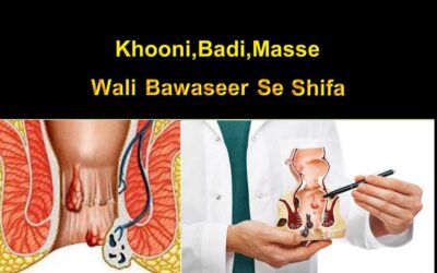 Khooni , Badi , Masse Wali Bawaseer Se Shifa