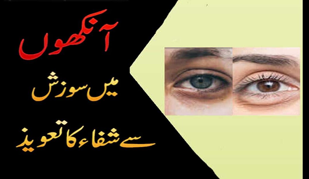 ankhoo mai suzish se shifa