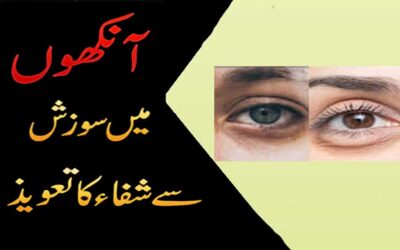 Ankhon Ki Sozish Khatam Karne Ka Taweez