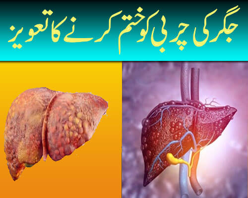 Fatty Liver Treatment