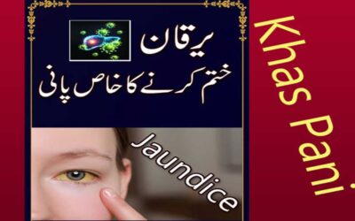 Yarkan Ki Bimari Ka Naqsh