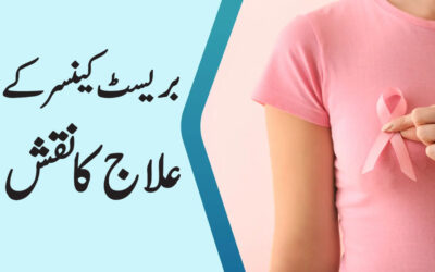 Breast Cancer Ke Ilaj Ka Naqsh