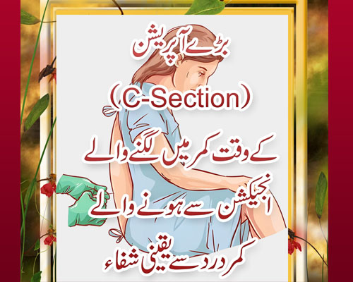 Kamar Mein Injection During C-Section | Delivery Ky Bad Qamar Mein Dard | Kamar Dard Se Shifah