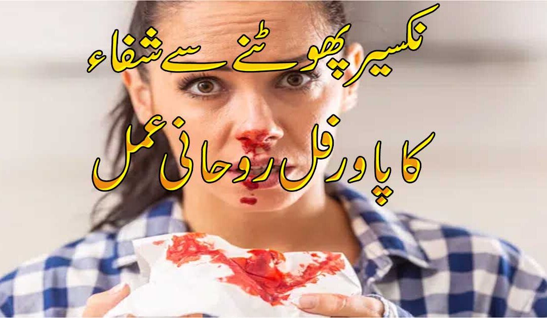 Nakseer Phatne Se Shifa Ka Amal