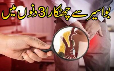 Bawaseer Se Shifa Ka Ilaj