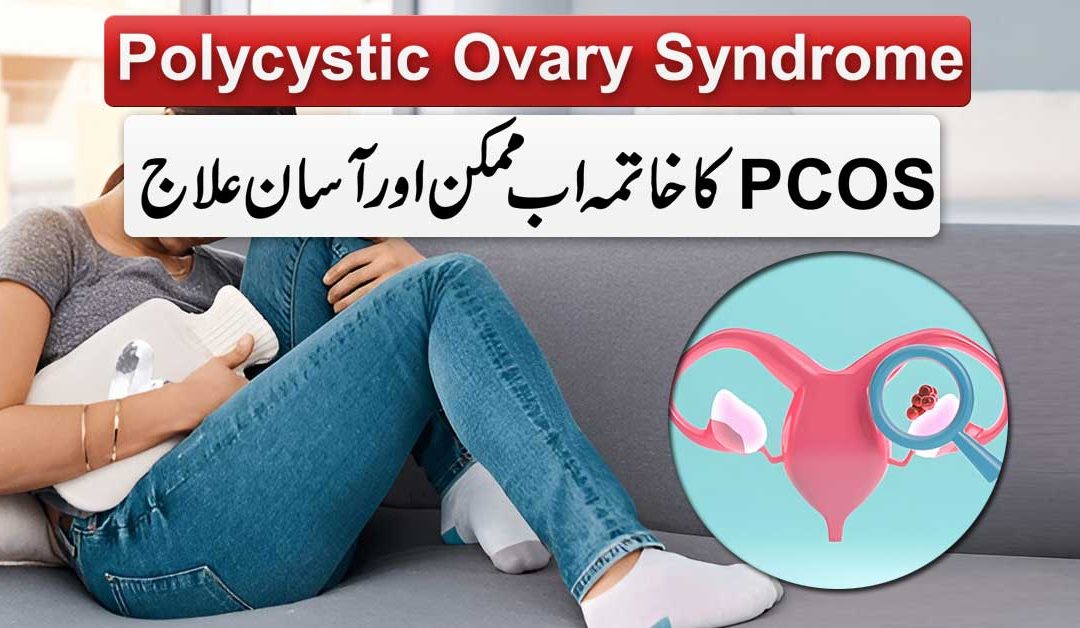 PCOS Ka Asan Ilaj