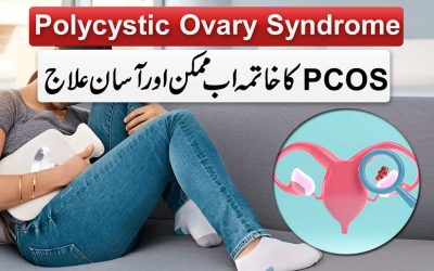 PCOS Ka Asan Rohani Ilaj