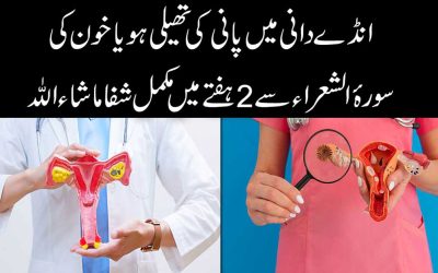 Ovarian Cyst Ka Rohani Taweez