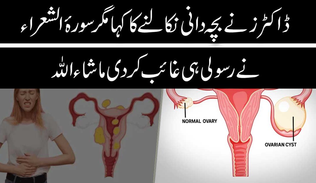 Bachedani Ki Rasoli Ka Ilaj