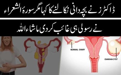 Bachedani Ki Rasoli Ka Rohani Ilaj