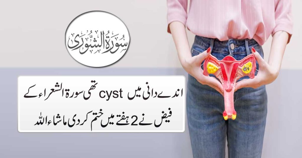 Cyst Pani Ki Theliyan Khatam Surah Shuara K Naqsh Se