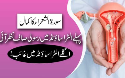 Rasoli Khatam Karne Ka Naqsh