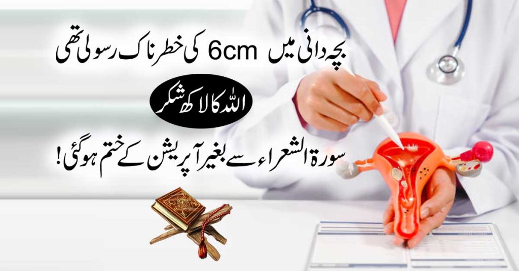 Fibroids Rasoli Banne Ka Amal Rokne Ka Taweez